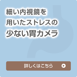 細かい内視鏡を用いたストレスの少ない胃カメラ